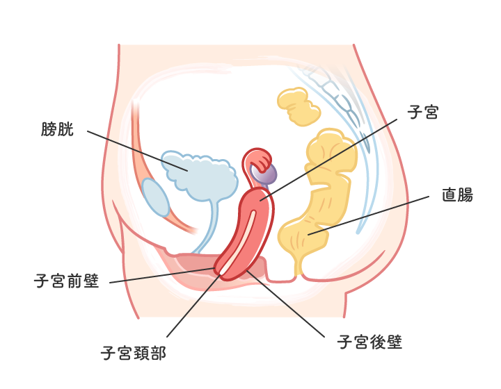 骨盤臓器脱